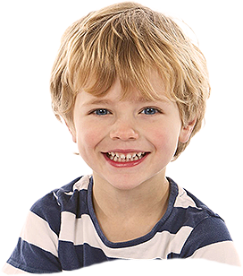 Cute boy for lip tie and tongue tie frenectomy